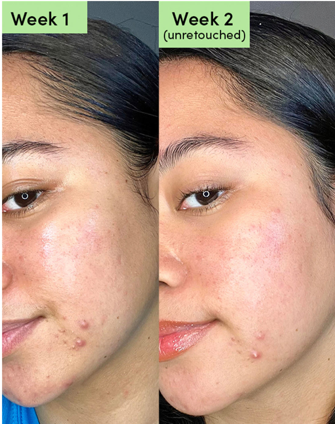 Oil Control Clearing Face Mask