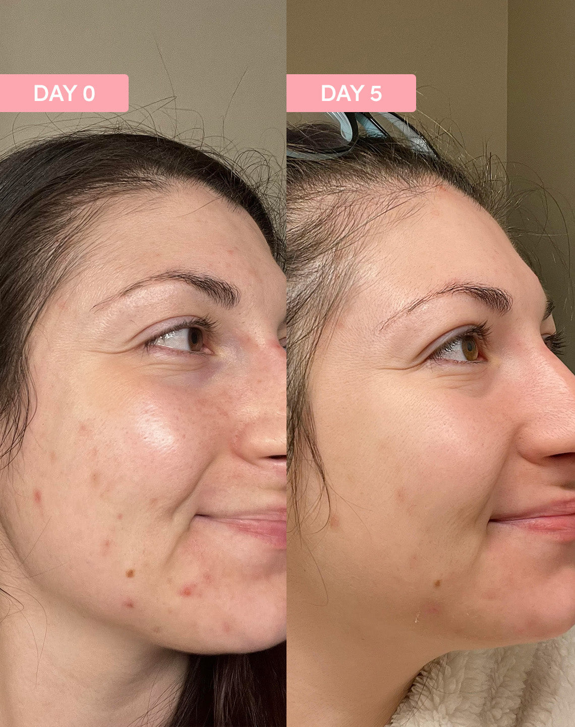 Pro Youth Dark Spot Serum