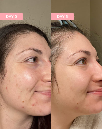 Pro Youth Dark Spot Serum
