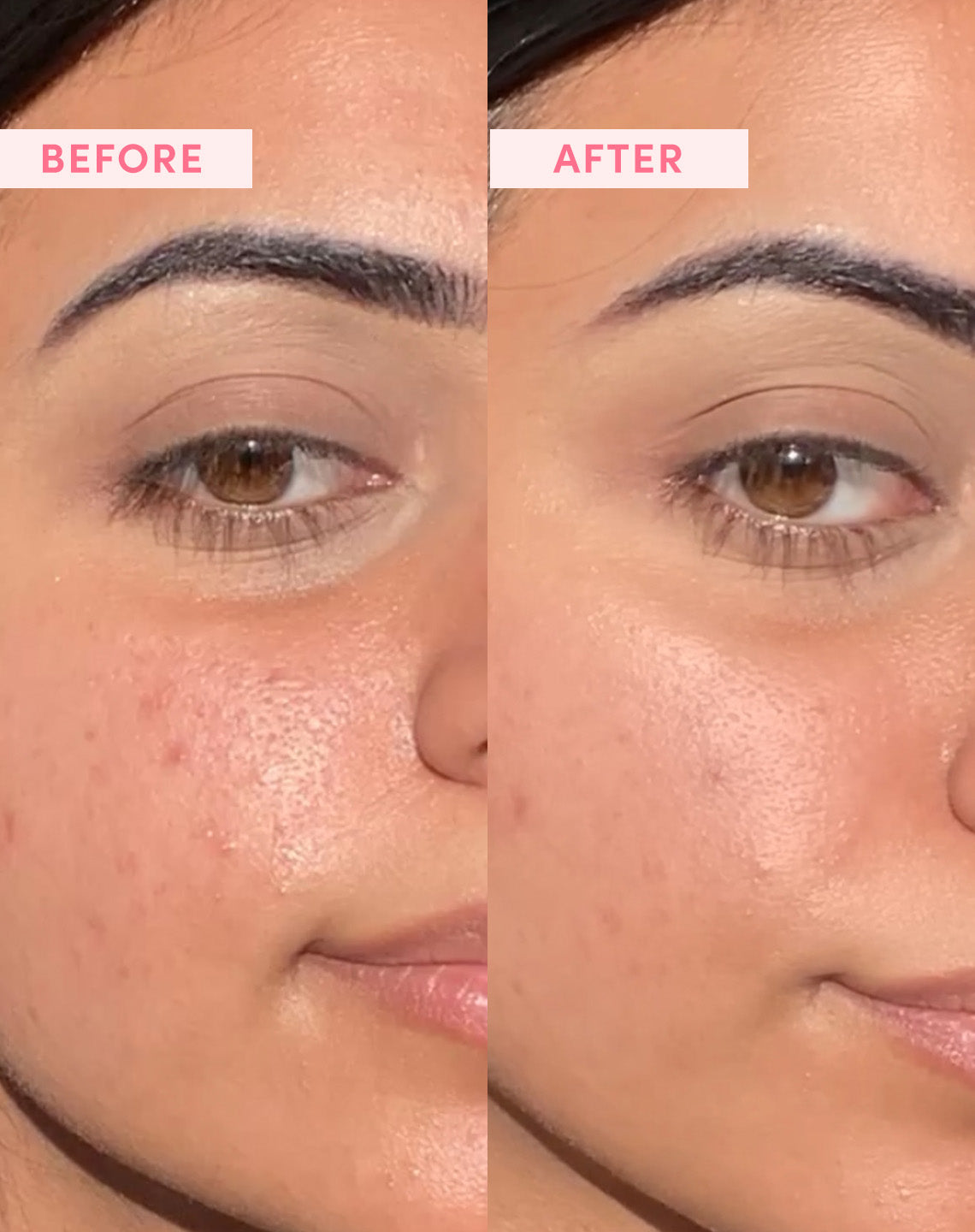 Australian Pink Clay Pore Tight Kit